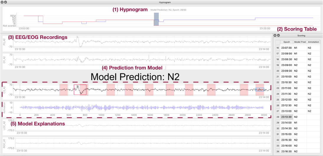 CDSS for Sleep Staging (2020.09)